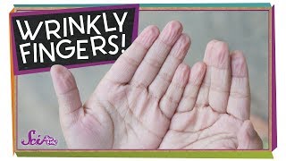 S01E04-Why do i get wrinkly fingers in the bat