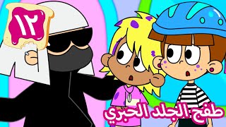 ۱۲- طفح الجلد الحبري